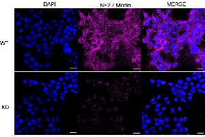 anti-Neurofibromin 2 (NF2) antibody