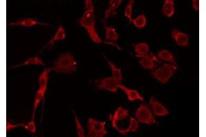 ABIN6274797 staining HepG2 by IF/ICC. (ACAT1 antibody  (Internal Region))
