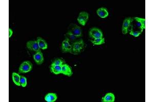 Immunofluorescent analysis of A431 cells using ABIN7171662 at dilution of 1:100 and Alexa Fluor 488-congugated AffiniPure Goat Anti-Rabbit IgG(H+L) (TBC1D9B antibody  (AA 724-1023))