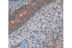 Used in DAB staining on fromalin fixed paraffin- embedded Kidney tissue (PLAP antibody  (AA 68-313))