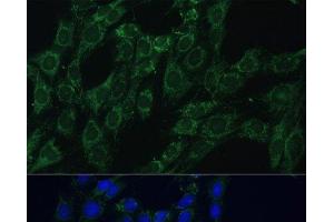 Immunofluorescence analysis of C6 cells using AEBP1 Polyclonal Antibody at dilution of 1:100 (40x lens). (AEBP1 antibody)