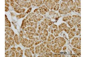 Image no. 1 for anti-Centromere Protein J (CENPJ) (AA 979-1089) antibody (ABIN599271) (CENPJ antibody  (AA 979-1089))