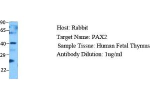 Host: Rabbit Target Name: PAX2 Sample Type: Human Fetal Thymus Antibody Dilution: 1. (PAX2A antibody  (Middle Region))