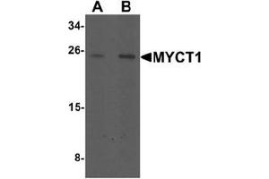 Western blot analysis of MYCT1 in rat lung tissue lysate with MYCT1 antibody at (A) 1 and (B) 2 ug/mL. (Myc Target 1 antibody  (C-Term))
