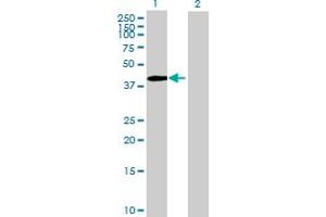Western Blot analysis of ZNF485 expression in transfected 293T cell line by ZNF485 MaxPab polyclonal antibody. (ZNF485 antibody  (AA 1-402))