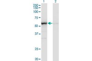 Western Blot analysis of OXSR1 expression in transfected 293T cell line by OXSR1 monoclonal antibody (M14), clone 1B10. (OXSR1 antibody  (AA 1-527))