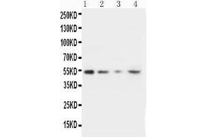 Lane 4: HELA Cell Lysate (MMP10 antibody  (C-Term))