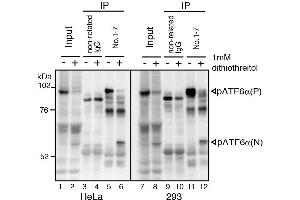 Western Blotting (WB) image for anti-Activating Transcription Factor 6 (ATF6) (N-Term) antibody (ABIN2451924) (ATF6 antibody  (N-Term))
