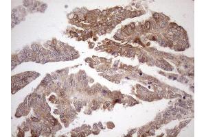 Immunohistochemistry (IHC) image for anti-Achalasia, Adrenocortical Insufficiency, Alacrimia (AAAS) (AA 322-546) antibody (ABIN2715861) (Adracalin antibody  (AA 322-546))