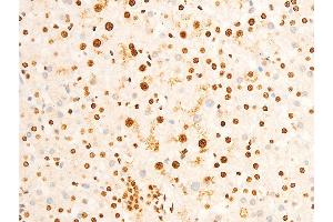 Immunohistochemistry (IHC) image for anti-Eukaryotic Translation Initiation Factor 2 Subunit 1 (EIF2S1) (pSer51) antibody (ABIN6255389)