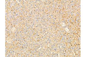 ABIN7094870 and ABIN7098922 at 1/100 staining Rat liver tissue by IHC-P. (Der1-Like Domain Family, Member 2 (DERL2) (C-Term) antibody)