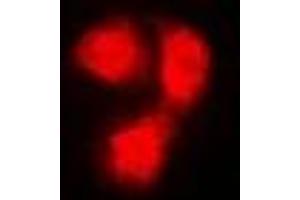 Immunofluorescent analysis of Beta 2 Microglobulin staining in Hela cells. (beta-2 Microglobulin antibody)