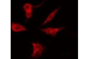 ABIN6275226 staining Hela by IF/ICC. (PGRMC2 antibody  (C-Term))