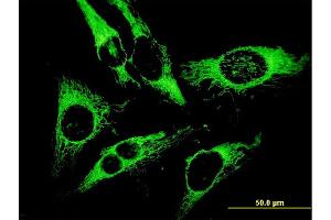 Immunofluorescence of monoclonal antibody to PRDX3 on HeLa cell. (Peroxiredoxin 3 antibody  (AA 1-256))