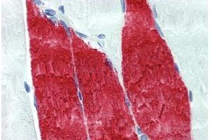 Troponin I antibody