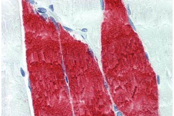 Troponin I antibody