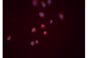 ABIN6276519 staining HeLa cells by ICC/IF.