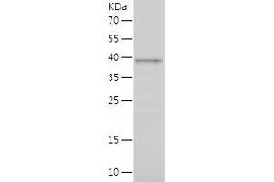 C9ORF72 Protein (AA 1-198) (His-IF2DI Tag)