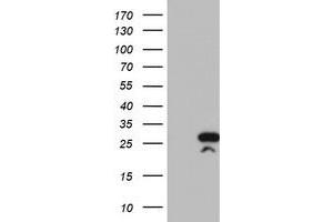 HEK293T cells were transfected with the pCMV6-ENTRY control (Left lane) or pCMV6-ENTRY RGS16 (Right lane) cDNA for 48 hrs and lysed. (RGS16 antibody)