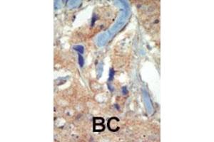 Immunohistochemistry (Paraffin-embedded Sections) (IHC (p)) image for anti-Fms-Related tyrosine Kinase 3 (FLT3) (AA 33-64), (N-Term) antibody (ABIN391981)