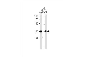 Western blot analysis of lysates from NCCIT, mouse F9 cell line (from left to right), using Sox2 Antibody (N-term) (ABIN6243281 and ABIN6577707). (SOX2 antibody  (N-Term))