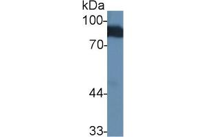 Detection of ANG in Human Serum using Polyclonal Antibody to Angiostatin (ANG) (Angiostatin antibody  (AA 79-466))