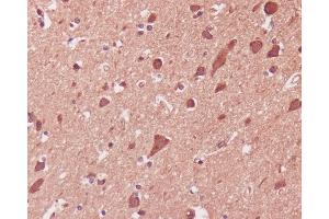 Immunohistochemical analysis of paraffin-embedded human brain, using p38 MAPK Antibody.