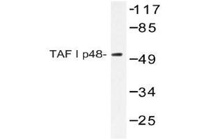 Western blot (WB) analyzes of TAF I p48 antibody in extracts from HeLa cells. (SET/TAF-I antibody)