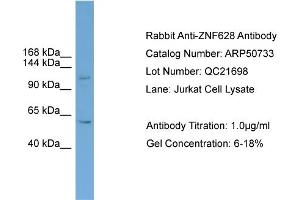 WB Suggested Anti-ZNF628  Antibody Titration: 0. (ZNF628 antibody  (Middle Region))
