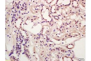 Formalin-fixed and paraffin embedded human kidney labeled with Anti-CCBR1 Polyclonal Antibody, Unconjugated (ABIN872924) at 1:200 followed by conjugation to the secondary antibody and DAB staining (SLC7A11 antibody  (AA 201-300))
