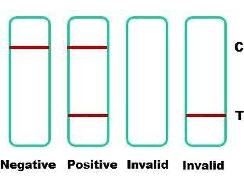 Sars Covid Antigen Test - Human Anti-SARS-CoV-2 (Covid-19) IgM Rapid Test | ABIN6952534