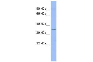 WB Suggested Anti-ASPH Antibody Titration:  0. (Aspartate beta Hydroxylase antibody  (Middle Region))