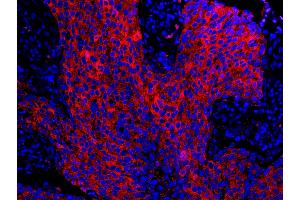 Immunofluorescence (IF) image for anti-Stratifin (SFN) (AA 198-248) antibody (ABIN7448925) (14-3-3 sigma/SFN antibody  (AA 198-248))