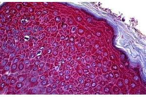 Human Skin: Formalin-Fixed, Paraffin-Embedded (FFPE) (CCR3 antibody  (N-Term))