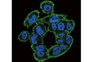 Confocal immunofluorescent analysis of UPA antibody with A2058 cells followed by Alexa Fluor 488-conjugated goat anti-rabbit lgG (green). (PLAU antibody  (AA 396-426))