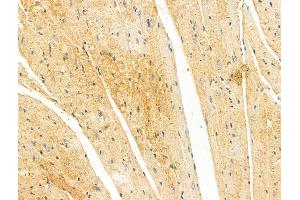 anti-Migration and Invasion Inhibitory Protein (MIIP) (Internal Region) antibody