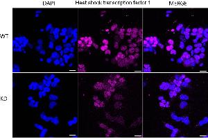 Immunocytochemical staining of 293T cells using Heat shock transcription factor 1 antibody (ABIN7798861), 1:1,000), Top panel: wild-type (WT), Bottom panal: Heat shock transcription factor 1 shRNA knockdown (KD). (Recombinant HSF1 antibody)