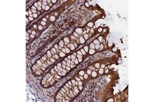 Immunohistochemical staining of human colon with CALY polyclonal antibody  shows strong cytoplasmic and membranous positivity in glandular cells. (CALY antibody)