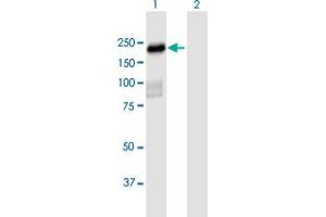anti-Pleckstrin Homology Domain Containing, Family H (With MyTH4 Domain) Member 2 (PLEKHH2) (AA 1-1493) antibody