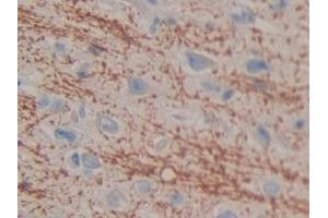 Detection of CIDEC in Human Cerebrum Tissue using Polyclonal Antibody to Cell Death Inducing DFFA Like Effector C (CIDEC) (CIDEC antibody  (AA 1-251))