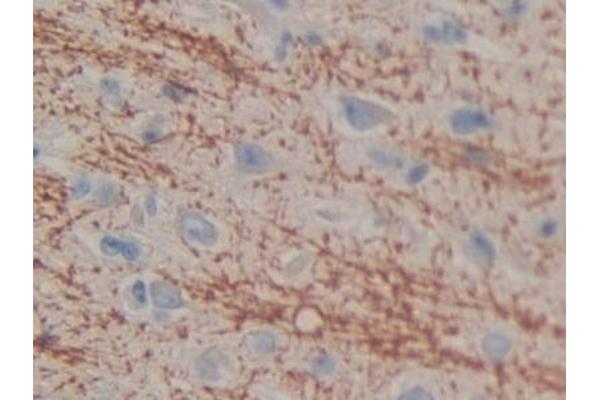 CIDEC antibody  (AA 1-251)