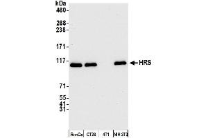 Western Blotting (WB) image for anti-HRS (HRS) (C-Term) antibody (ABIN7450342) (HRS (HRS) (C-Term) antibody)