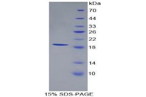 SDS-PAGE (SDS) image for Renalase, FAD-Dependent Amine Oxidase (RNLS) (AA 18-150) protein (His tag) (ABIN2126658)