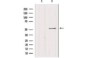 Western blot analysis of extracts from 293, using CALCOCO2 antibody.