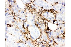 Immunohistochemistry (IHC) image for anti-Annexin A5 (ANXA5) (AA 2-320) antibody (ABIN3043502)