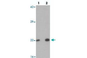 Western blot analysis of PHOX2B in 293 cell lysate with PHOX2B polyclonal antibody  at (lane 1) 1 and (lane 2) 2 ug/mL. (PHOX2B antibody  (Internal Region))