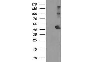 HEK293T cells were transfected with the pCMV6-ENTRY control (Left lane) or pCMV6-ENTRY AIPL1 (Right lane) cDNA for 48 hrs and lysed. (AIPL1 antibody)