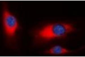 Immunofluorescent analysis of PAK1 staining in HeLa cells. (PAK1 antibody)