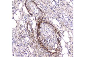 IHC analysis of Serum Amyloid P using anti-Serum Amyloid P antibody . (APCS antibody  (AA 20-220))