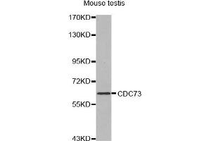 Western Blotting (WB) image for anti-Parafibromin (CDC73) (AA 435-505) antibody (ABIN1679121)